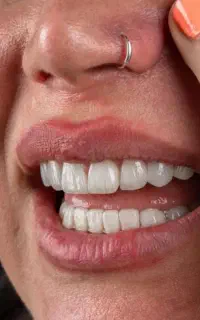 جشنواره طلایی دندانپزشکی با %20درصد تخفیف ویژه