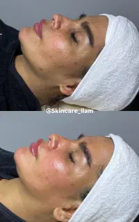 فیشال تخصصی
