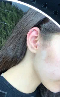 دیگه موقع اش رسیده پرسنگ بزنی حالتو خوب کنی