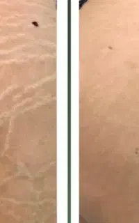وایتینینگ بیکینی و زیر بغل