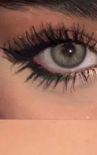 کاشت مژه