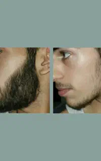 مشاوره ریش و سبیل و مو
