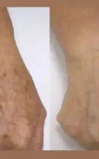کرم دست بیوممتیک