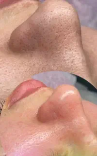 فیشیال وی ای پی با تخفیف ویژه