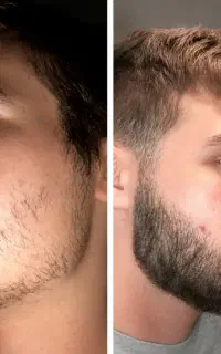 ریش و سیبیل پرپشتتو بساز
