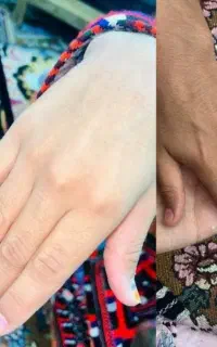 فرمول قوی سفید کننده صورت و دست و پا