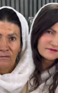 مدل جوانسازی شفافسازی چروک لیفت پوست به مدت محدود
