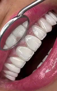 ایمپلنت اورتودنسی اقساطی توسط جراح فک و صورت