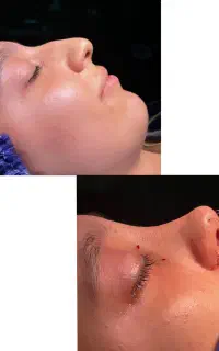۳۷زیبایی بینی اا