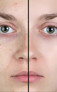 بهترین‌کرم‌سفیدکننده ضدجوش ضدلک ترمیم‌کننده دلارا