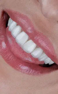 دندانپزشکی ستارخان اقساط ایمپلنت کامپوزیت عصبکشی