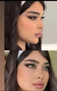 عمل بینی با یکی از بهترین متخصص های تهران