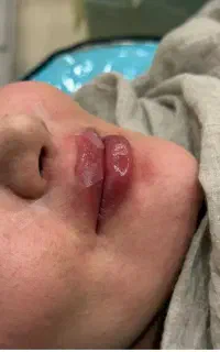 کلینیک زیبایی تزریق فیلر بوتاکس جوانسازو...