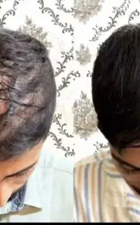 با این درمان موهاتو باید دم اسبی ببندی