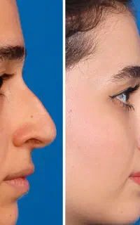 فرصت استثنایی عمل بینی