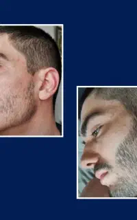 میخوای درش بیاری