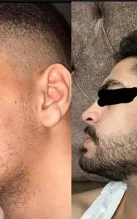 ریشاتو با ما تقویت کن