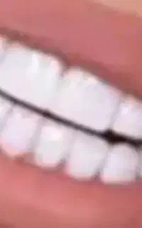 مرکز  پروتز. دندانی مهر دنتال