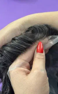 پروتز مو، با چک صیادی