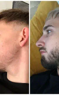 ریش چهرتو خیلی پخته میکنه