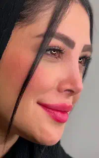 عمل جراحی بینی از۳۹/قیمت قبل/بلفارو /غبغب