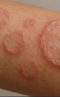 کرم
