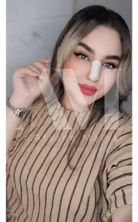 جراحی بینی.عمل زیبایی بینی توسط متخصص زیبایی