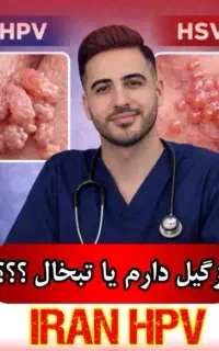 درمان بدون بازگشت زگیل تناسلی زیر نظر کادر درمان