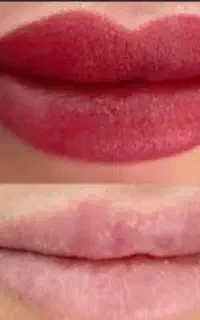 یک فرصت استثنایی برای داشتن چهره ای ایده‌آل