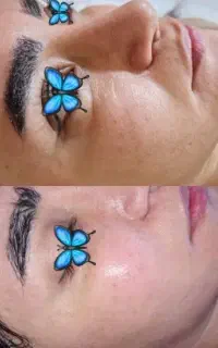 پاکسازی پوست