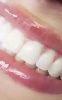 وی ام لمینت اورال