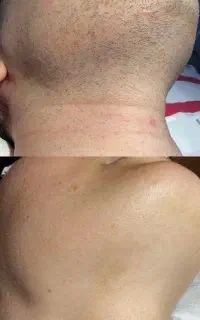 جشنواره تخفیف بهاره لیزر در کلینیک دژاباد