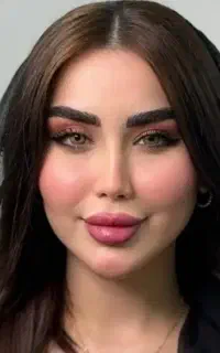 مدل فیلر و بوتاکس (فقط هزینه مواد گرفته میشود)