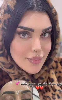 لیفت تخصصی صورت بانخ.افزایش سایزآلت آقا.ژل بوتاکس