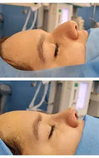 عمل بینی فقط چهل و سه تومن