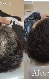 کلینیک تخصصی مزوتراپی و ژل و بوتاکس