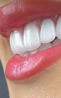 دندانپزشک دکترکریمی عصب کشی پرکردن کامپوزیت زیبایی
