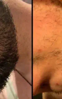 اشکال نداره اگه ۱۶ سالت رد شده و ریش نداری