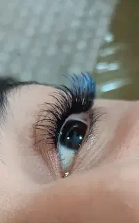 کاشت هیدن با ماندگاری بالا