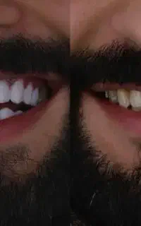 خدمات دندانی