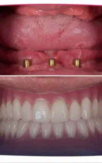 دندانپزشکی شبانه روزی زهره صادقیه غرب تهران