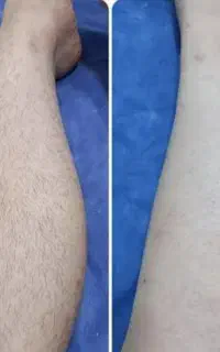 خدمات اپلاسیون وکاشت مژه