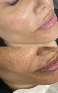 آموزش تخصصی پاکسازی پوست