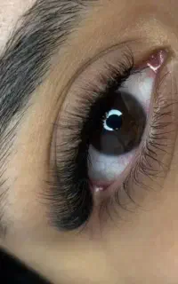 کاشت مژه