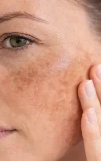 جراحی و خدمات زیبایی