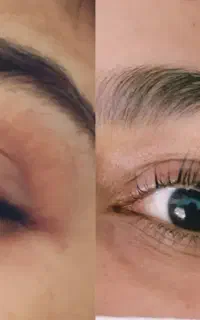 پرپشتی مژه