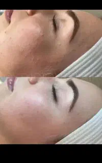 کرم معجزه صورت وبدن اصلی گورک کله بندی