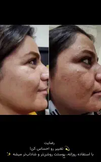 فیشیال وماساژ بدن