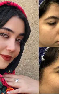 عمل جراحی به سبک پیزو ،ویژه جشنواره