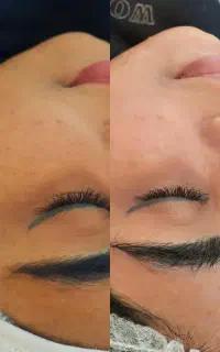 انجام خدمات پاکسازی صورت